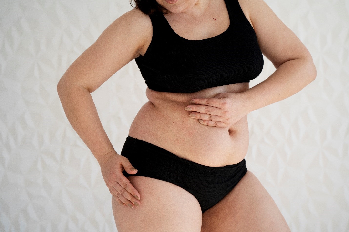 סימני מתיחה אחרי לידה